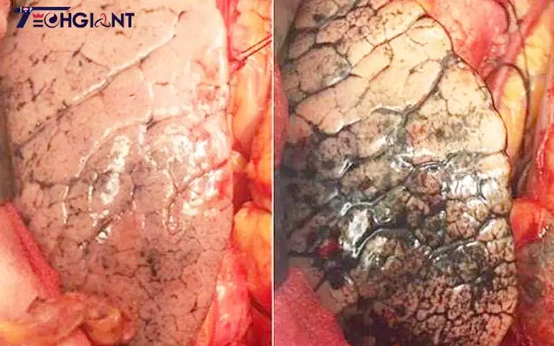 lung before and after air pollution